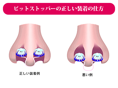 Pit Stopper Nose Filters (Regular Size), 3 Pairs