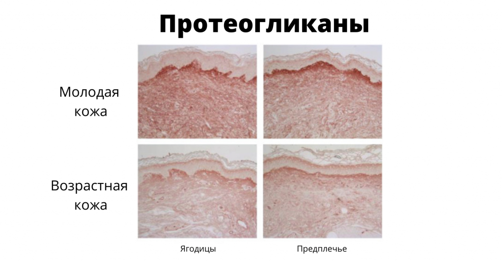 Протеогликаны – незаменимые белки для здоровья суставов и молодости ...