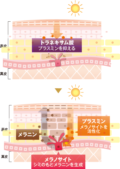 tranexam-detail1 (1).png tranexam-detail1 (1).png