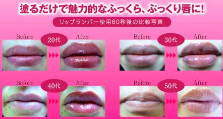 Amenity Lip Plumper Complex XL balm for lip augmentation
