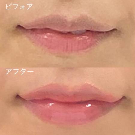 DR.SOIE Smooth Line Lip Plumper 