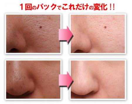 Monster stretch pack VC100 Xiva Mask to narrow pores and rejuvenation