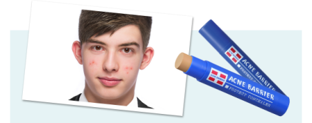 ISHIZAWA Mens Acne Barrier Concealer Acne treatment concealer, 5g