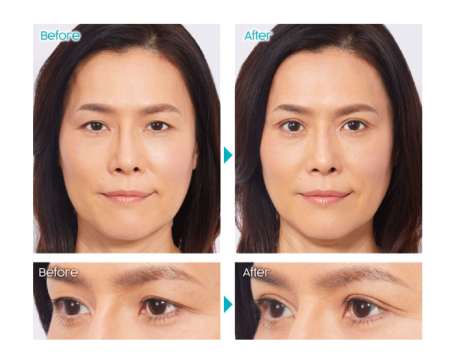 D-UP Orishiki Eyelid Skin Film, 4 ml