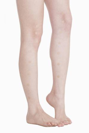 Shinshu Hi Acupuncture needles, 30 pieces