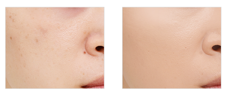 картинка Kose ESPRIQUE (Refill) Liquid compact BB cream powder, 13 g магазин одежды и аксессуаров являющийся официальным дистрибьютором в России  Kose ESPRIQUE (Refill) Liquid compact BB cream powder, 13 g