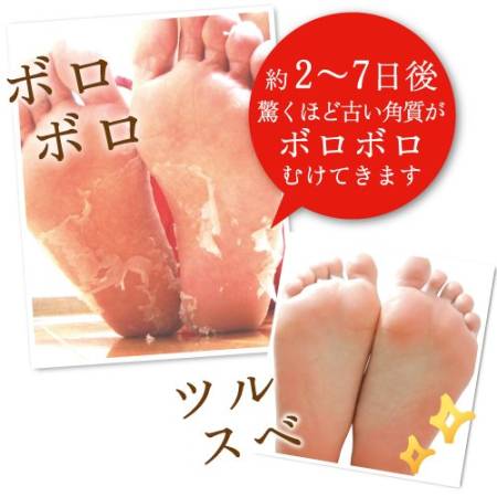 Baby Foot Foot Peeling, 30 minutes