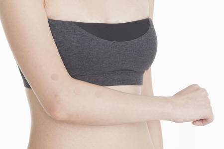 Shinshu Hi Acupuncture needles, 30 pieces