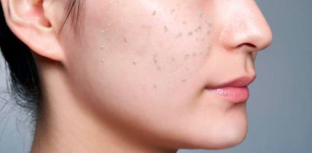 COGIT HADA Method Retinol Peeling Gel with retinol to improve the microrelief of the skin and complexion, 120 g