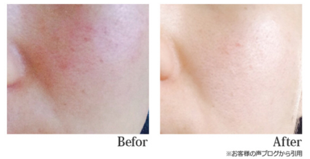 Japanese Skincare - Buy ONEC Whitetea Premium Serum Premium serum for face with whitening effect 30ml Online from Japan | 36Best Kawai ONEC Whitetea Premium Serum Premium serum for face with whitening effect 30ml