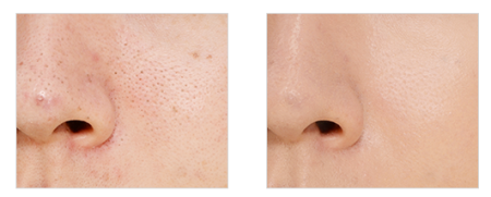 картинка Kose ESPRIQUE (Refill) Liquid compact BB cream powder, 13 g магазин одежды и аксессуаров являющийся официальным дистрибьютором в России  Kose ESPRIQUE (Refill) Liquid compact BB cream powder, 13 g